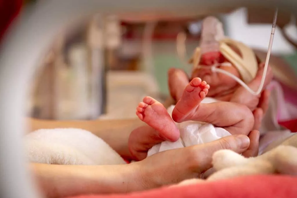 What exactly is premature birth?
